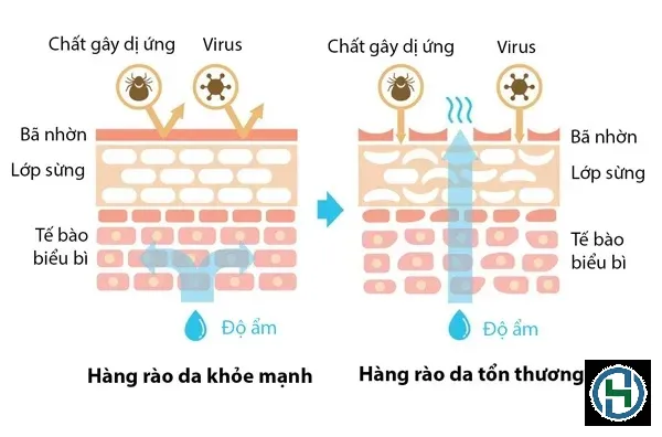 Sự mất cân bằng pH và tác động của chất tẩy rửa làm suy yếu hàng rào bảo vệ tự nhiên của da